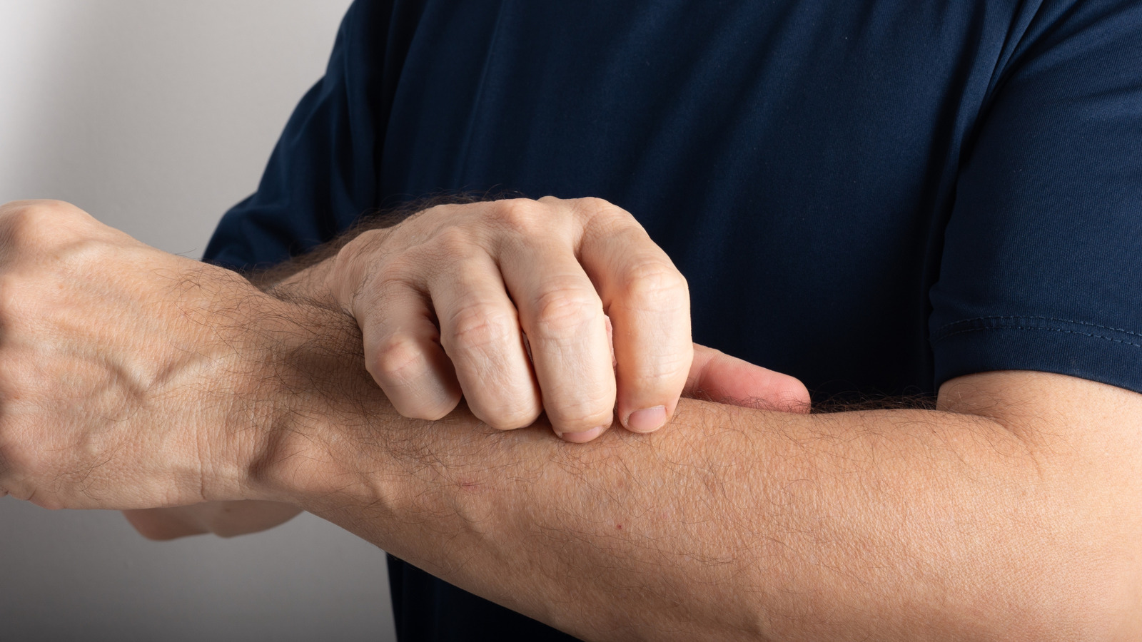 Det vanligt felaktiga tecknet på bältros du inte bör ignorera