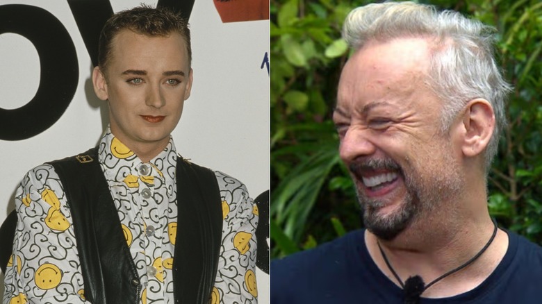 Boy George när han började tappa håret och efter en hårtransplantationsoperation