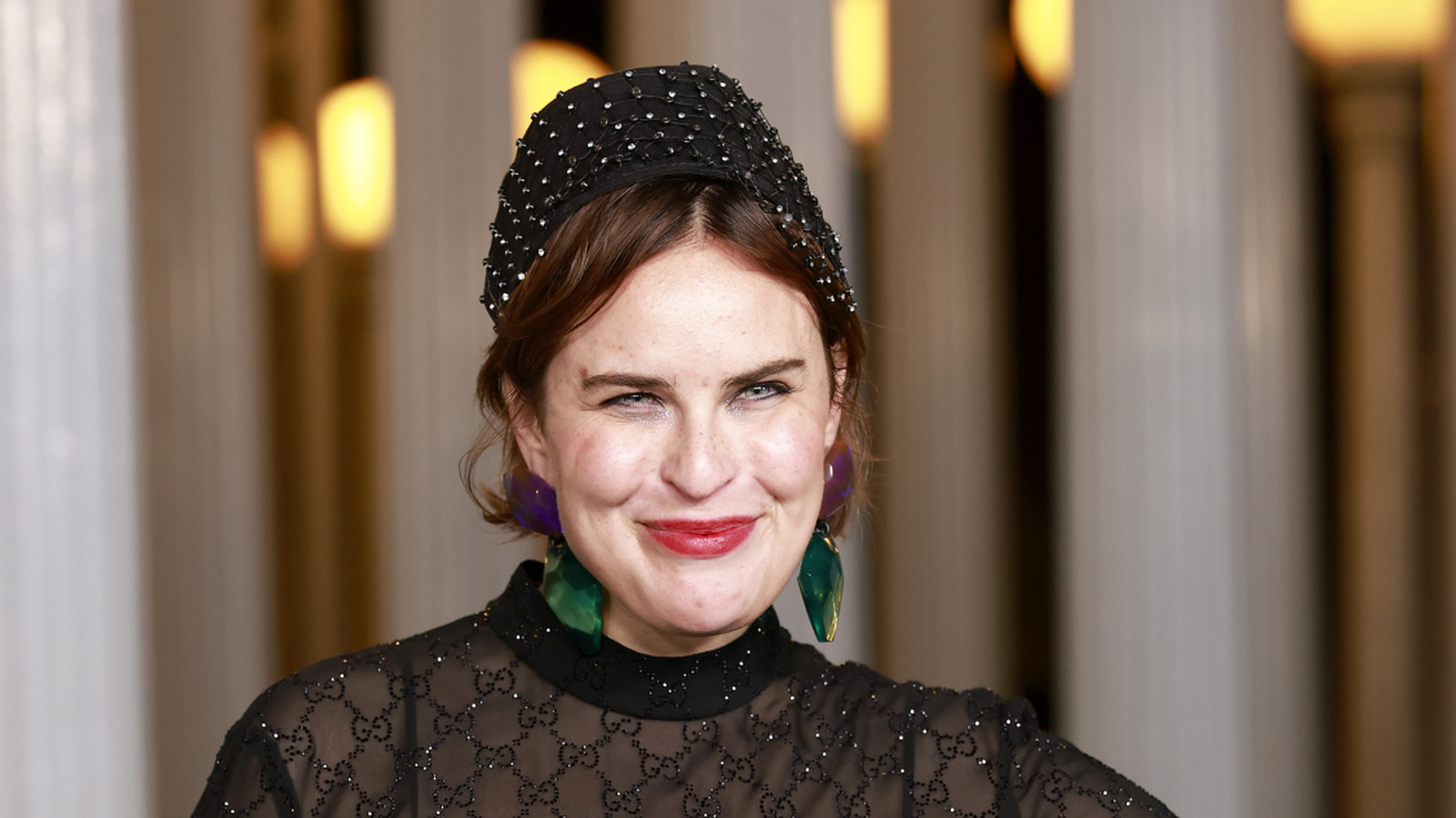 Tallulah Willis löste upp sitt fyllmedel och före- och efterbilderna är fantastiska