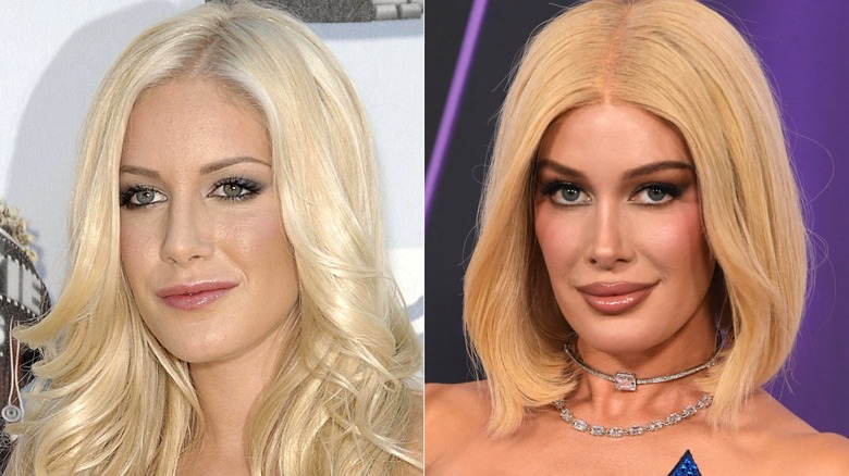 Heidi Montag ser mer naturlig ut 2008 och med ett uppjusterat ansikte 2025