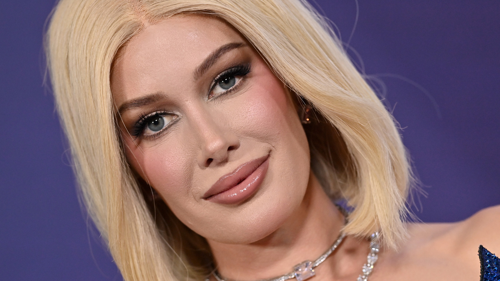 Före- och efterbilder av Heidi Montag visar hennes dramatiska ansiktsförvandling