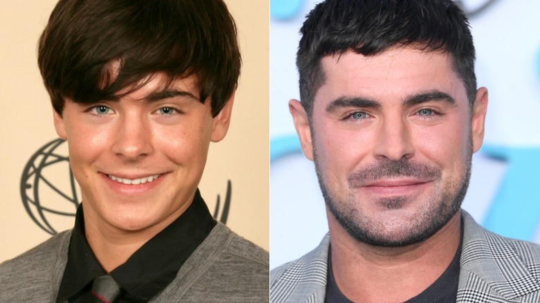 zac efron före och efter att han fick sin käke kopplad och återhämtade sig från skadan