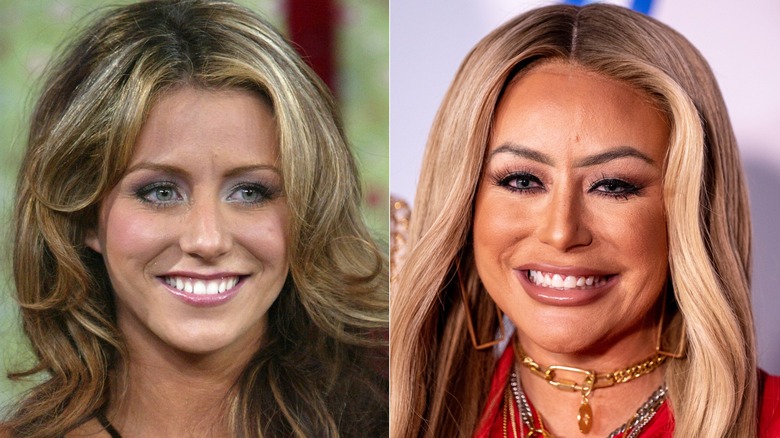 Aubrey O'Day ser naturlig ut 2005 och efter Botox och filler 2024