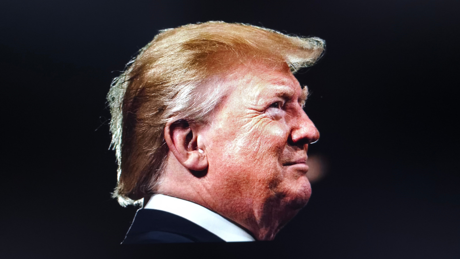Donald Trumps hår i bilder berättar en bekant historia för män i hans ålder