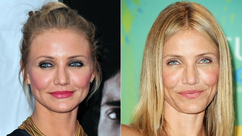 Foton sida vid sida som visar Cameron Diaz före och efter användning av Botox