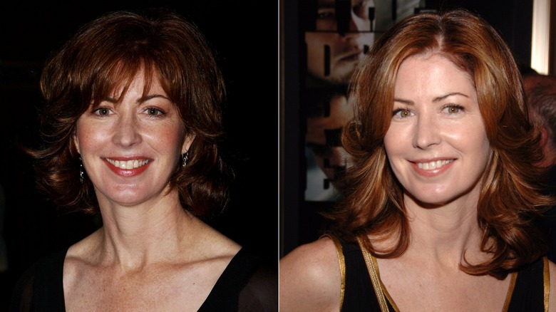 Foton sida vid sida som visar Dana Delany före och efter användning av Botox