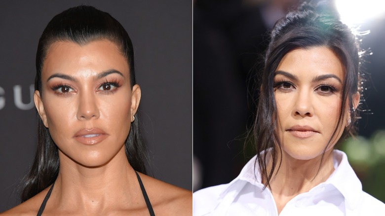 Foton sida vid sida som visar Kourtney Kardashain före och efter användning av Botox