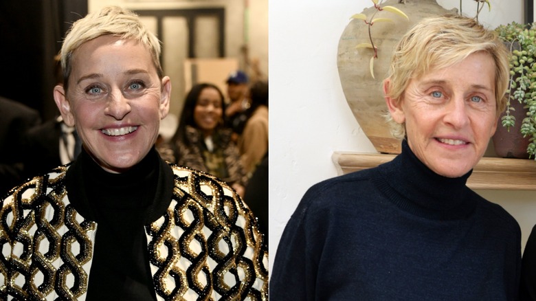 Foton sida vid sida som visar Ellen DeGeneres före och efter användning av Botox