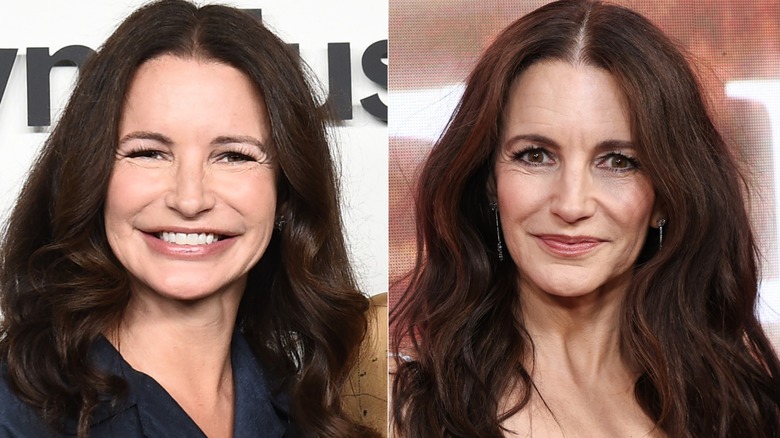 Kristin Davis före och efter att hon löste upp sitt ansiktsfyllmedel