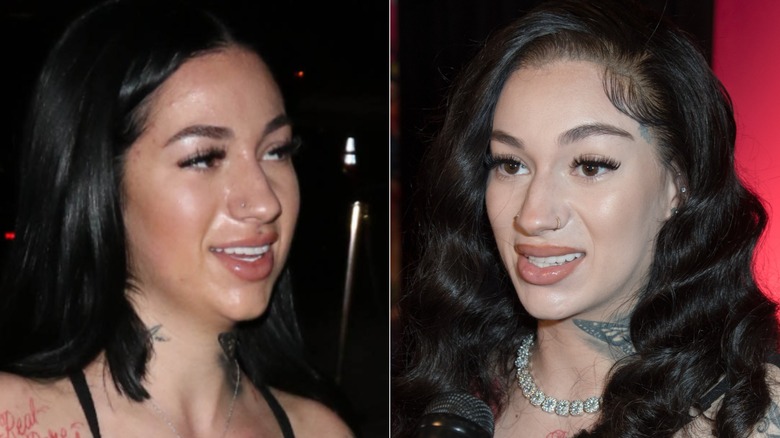 Bhad Bhabie före och efter att hon tog bort sina fillers