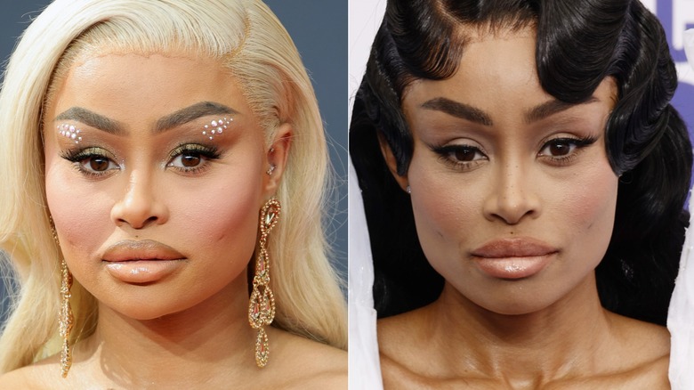 Blac Chyna före och efter upplösning av hennes ansiktsfillers