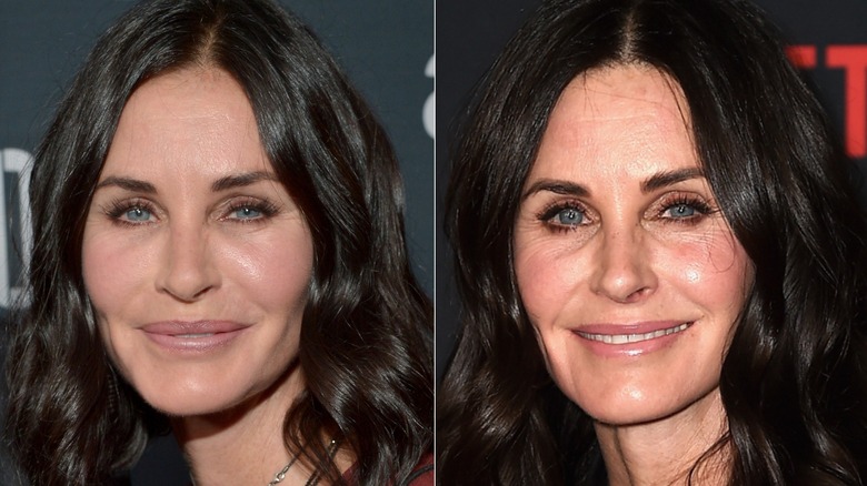 Courteney Cox före och efter bestämde hon sig för att ta bort sina ansiktsfillers