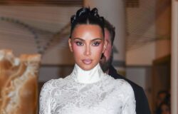 Kim Kardashian har haft ett hjärnaneurysm i flera år – hur vanligt är det?